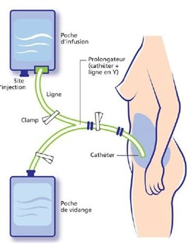 Soins Dialyse Infirmiere